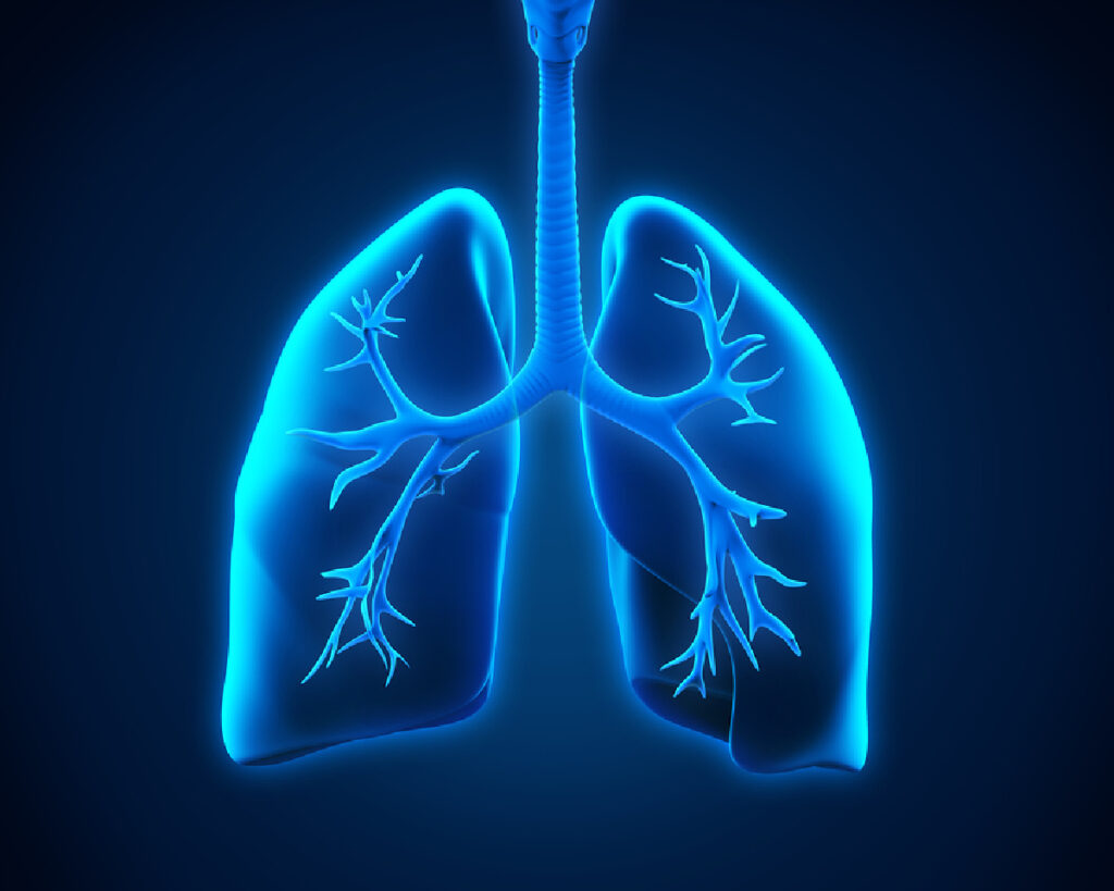 Senior Care in Lake Forest IL: Lung Cancer